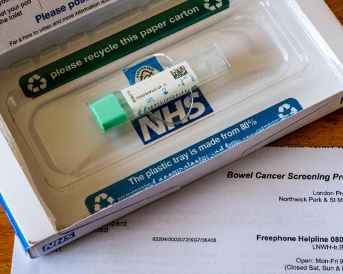 England Lowers Blood Level in Stool Test to Spot Bowel Cancer Earlier